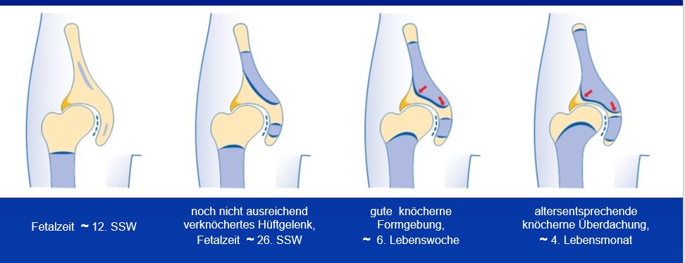 Huftentwicklung